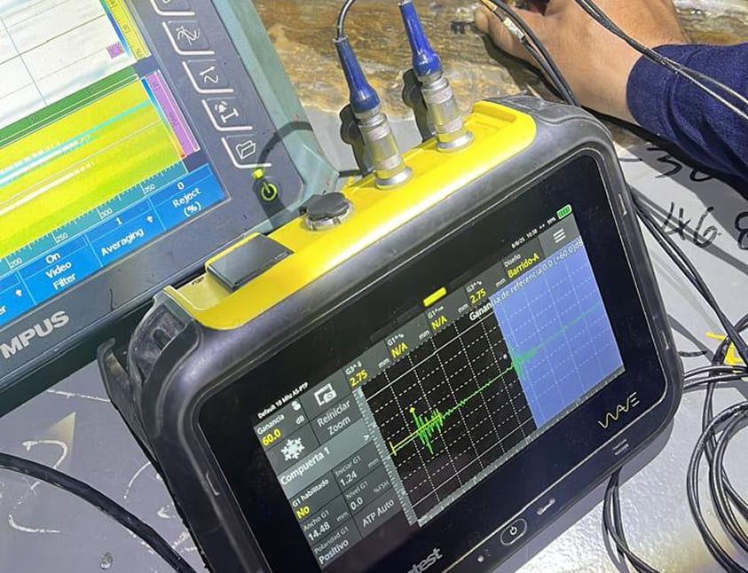 Revisión ultrasonido