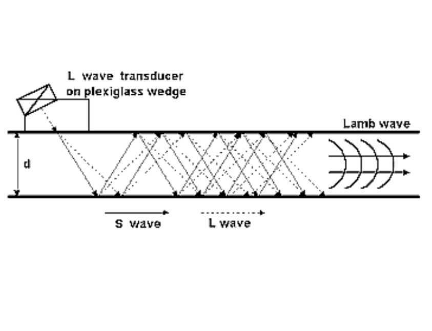 Imagen explicativa de un ultrasonido